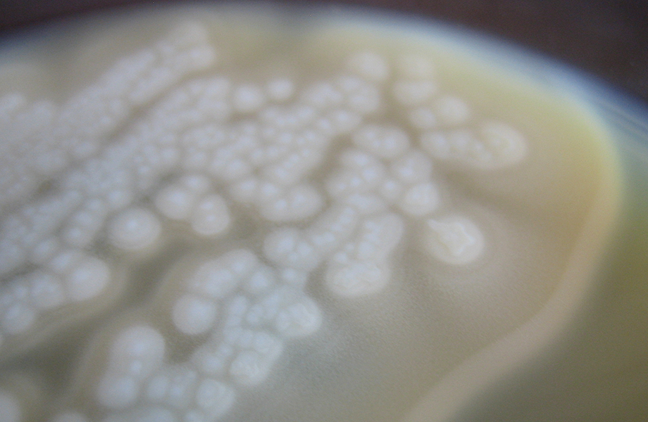 Esterilització d'aliments envasats en conserva, risc de Clostridium Botulinum