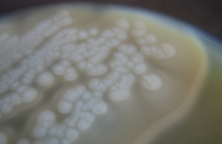 El valor F0 a l'eliminació del Clostridium botulinum